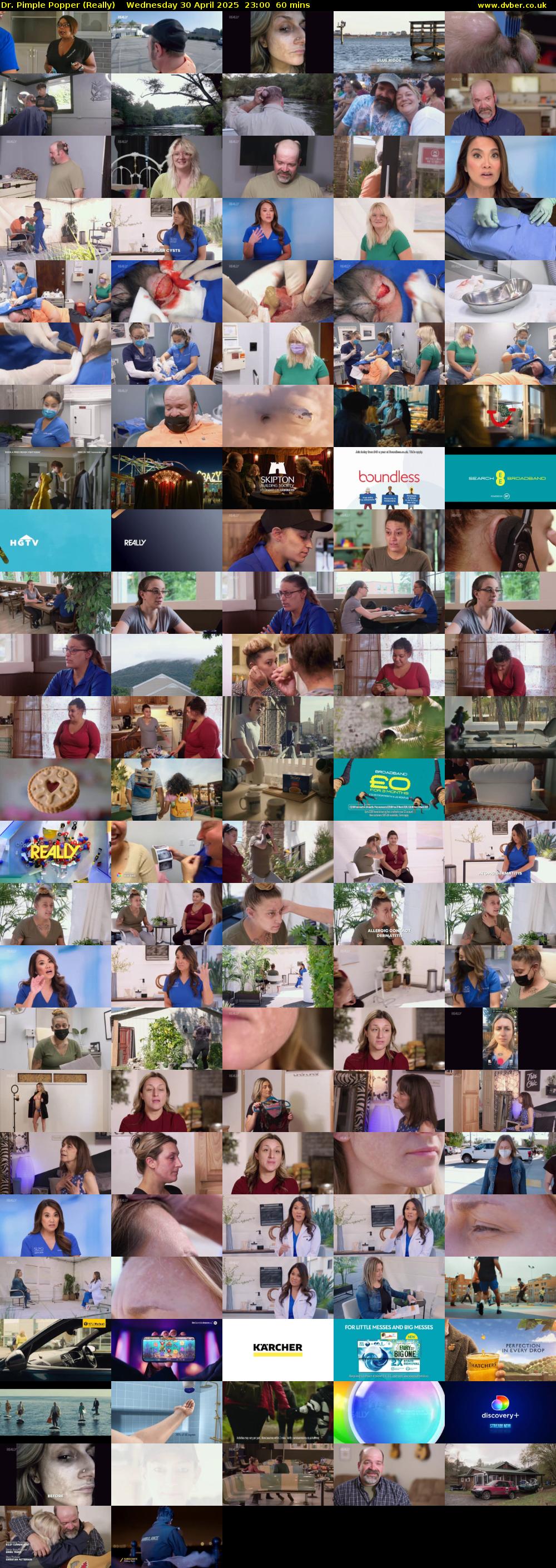 Dr. Pimple Popper (Really) Wednesday 30 April 2025 23:00 - 00:00