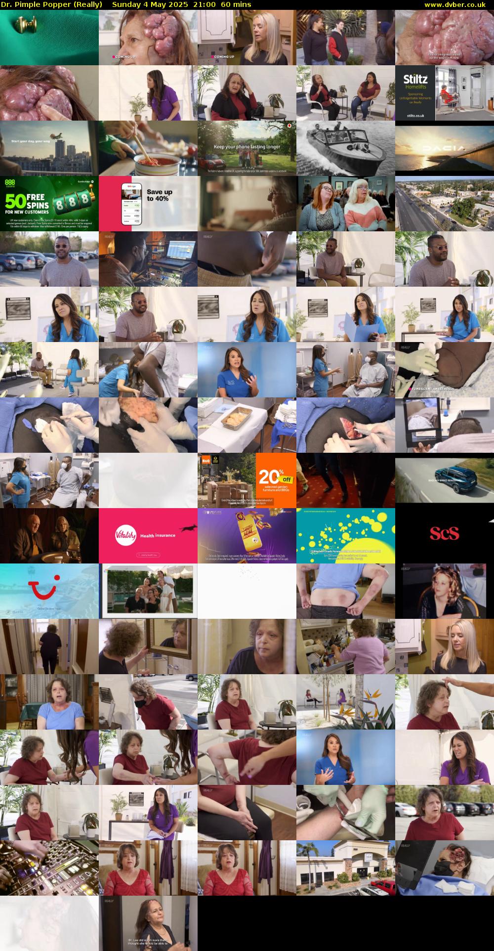 Dr. Pimple Popper (Really) Sunday 4 May 2025 21:00 - 22:00