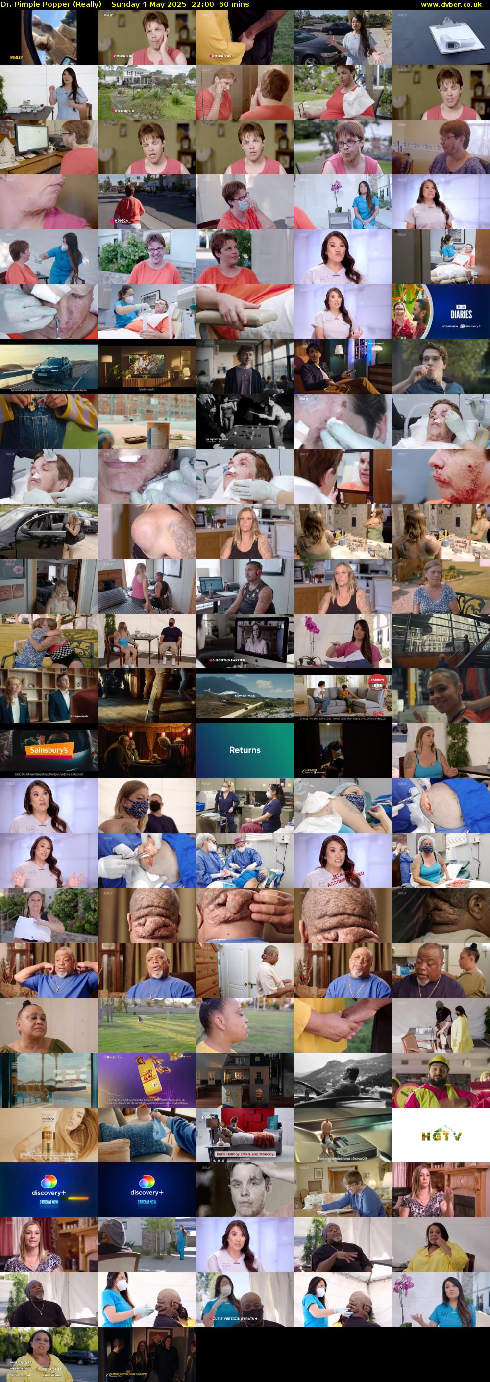 Dr. Pimple Popper (Really) Sunday 4 May 2025 22:00 - 23:00