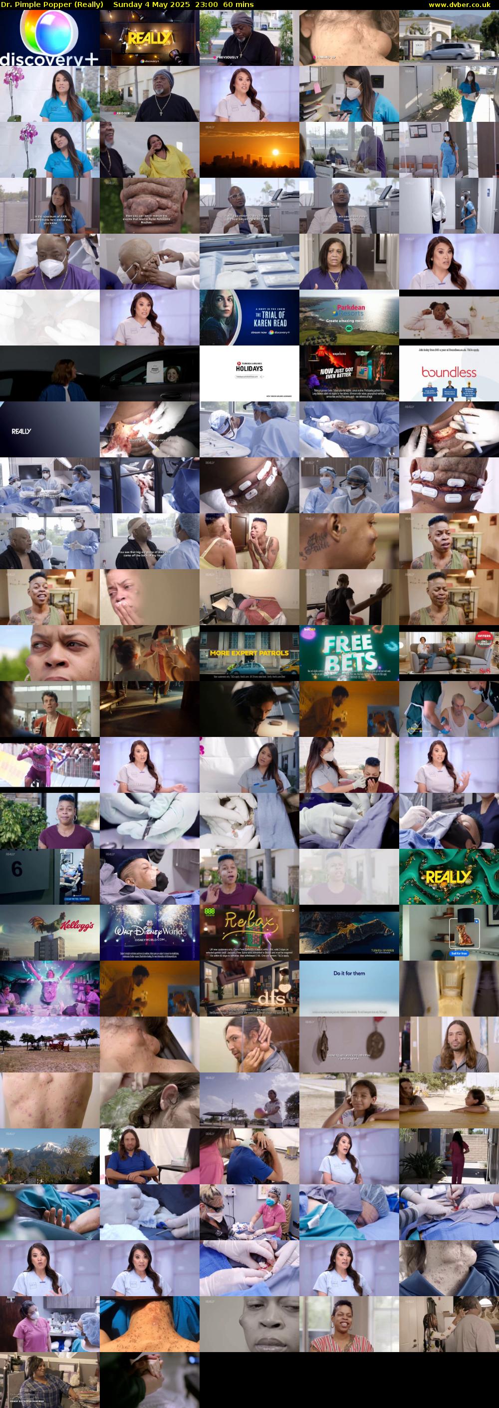 Dr. Pimple Popper (Really) Sunday 4 May 2025 23:00 - 00:00