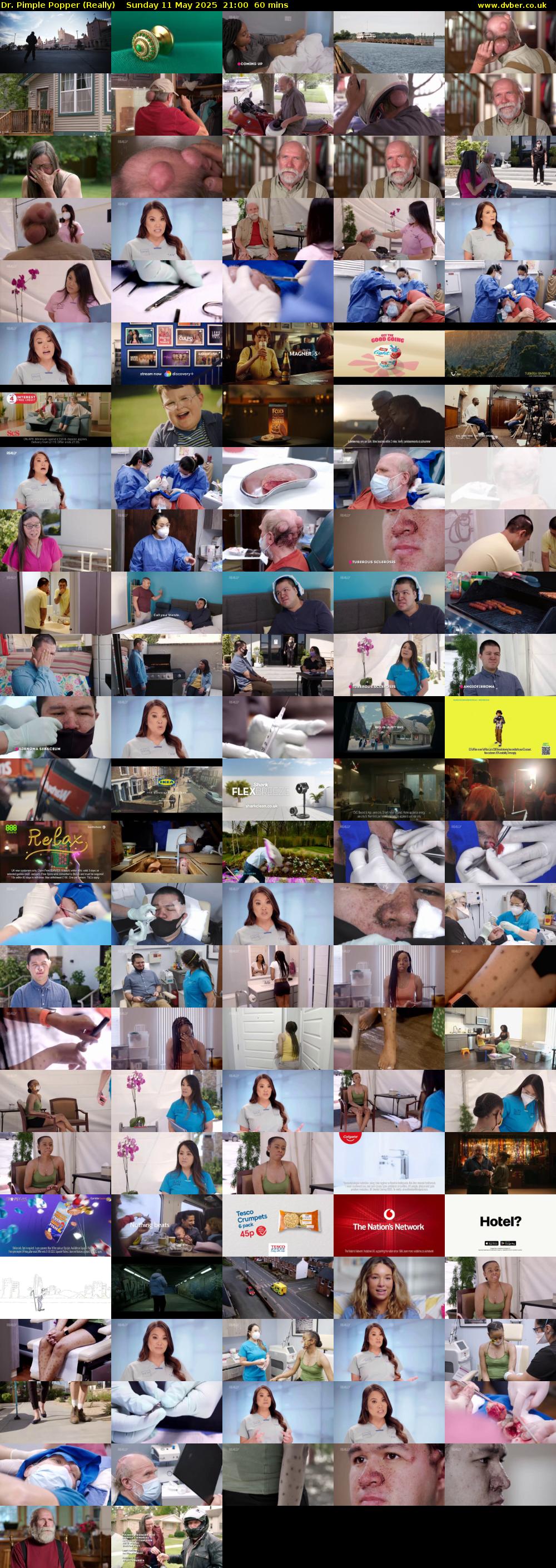 Dr. Pimple Popper (Really) Sunday 11 May 2025 21:00 - 22:00