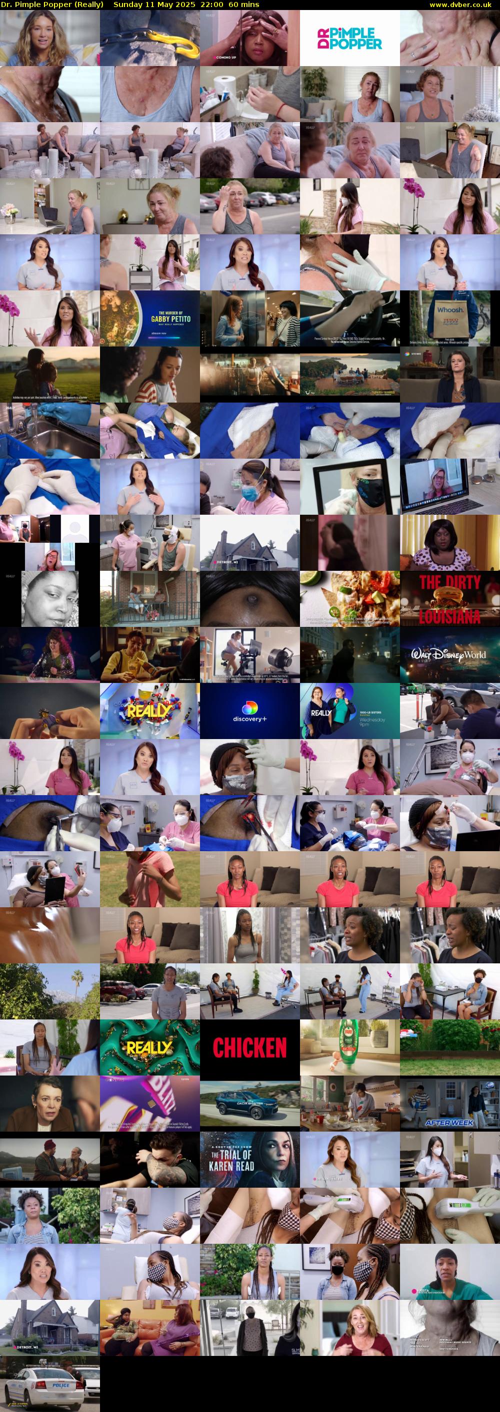 Dr. Pimple Popper (Really) Sunday 11 May 2025 22:00 - 23:00