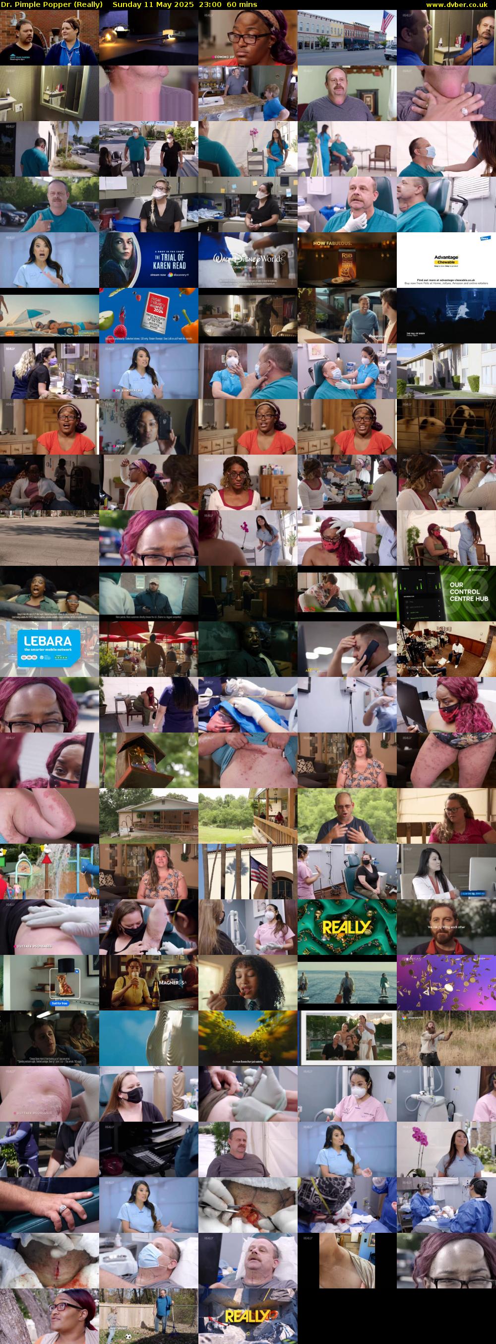 Dr. Pimple Popper (Really) Sunday 11 May 2025 23:00 - 00:00