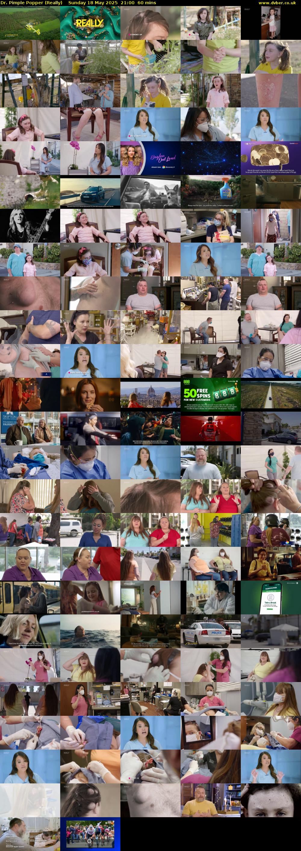 Dr. Pimple Popper (Really) Sunday 18 May 2025 21:00 - 22:00