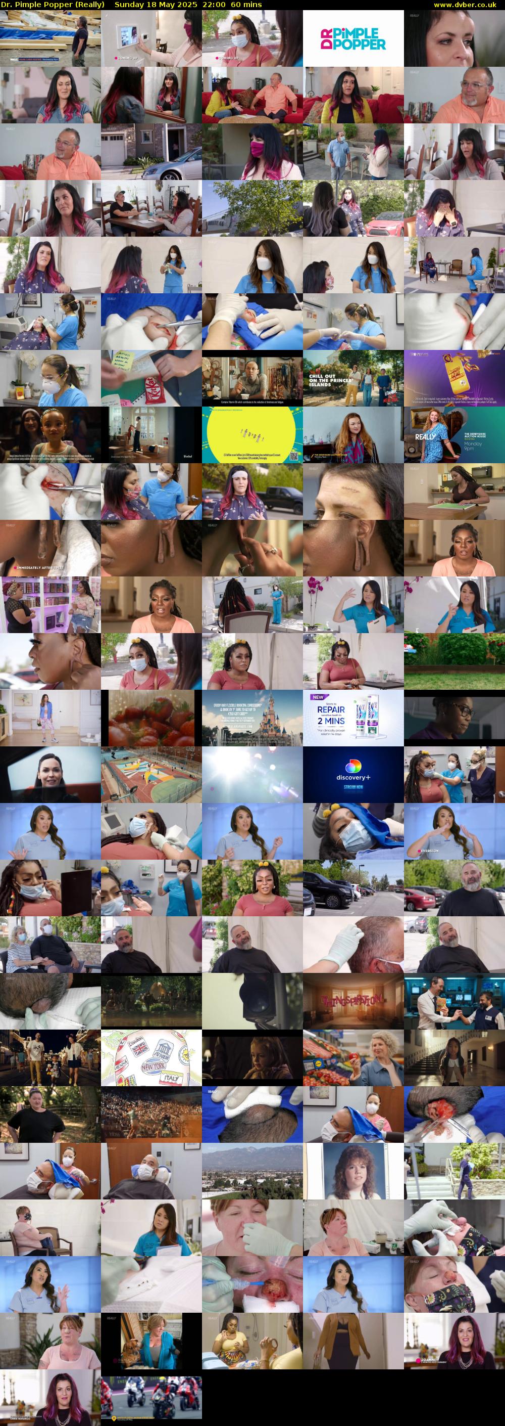 Dr. Pimple Popper (Really) Sunday 18 May 2025 22:00 - 23:00