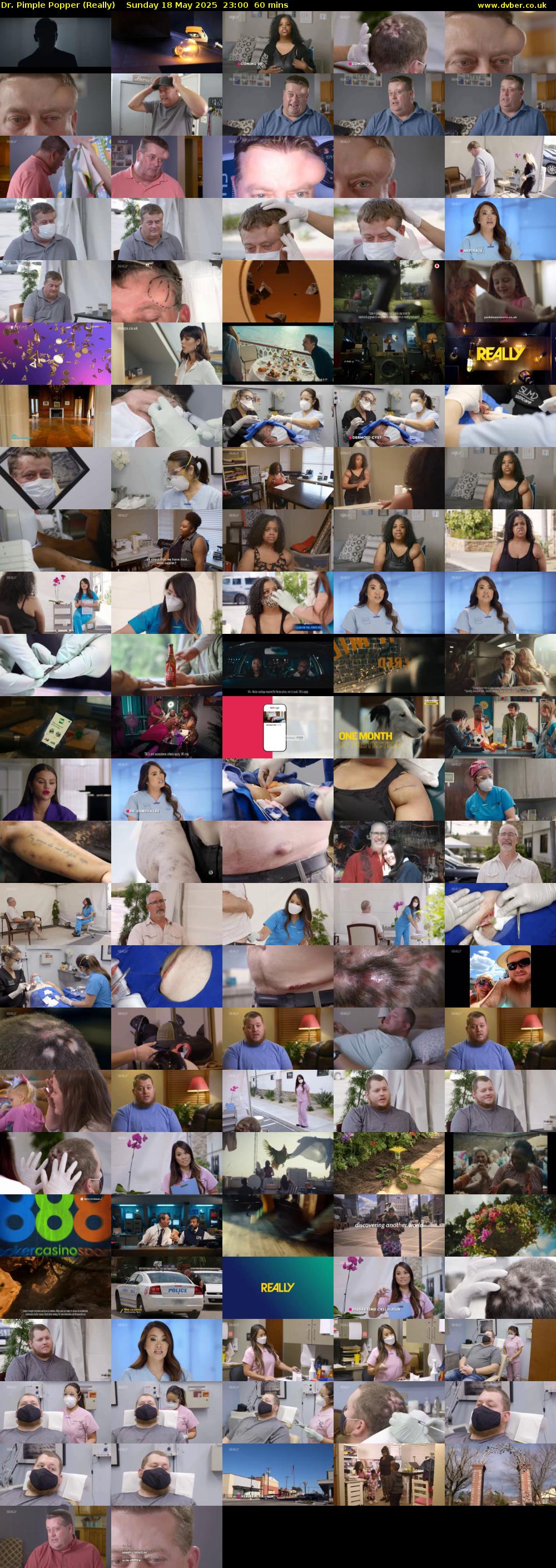 Dr. Pimple Popper (Really) Sunday 18 May 2025 23:00 - 00:00
