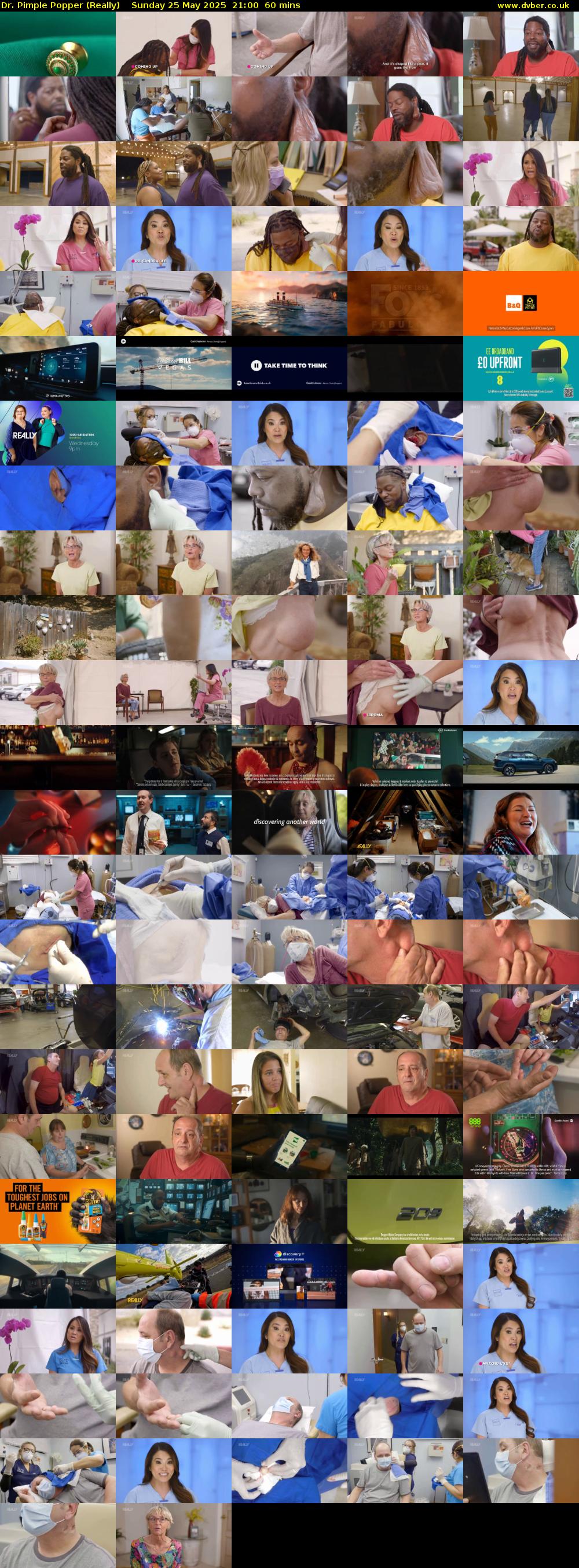 Dr. Pimple Popper (Really) Sunday 25 May 2025 21:00 - 22:00