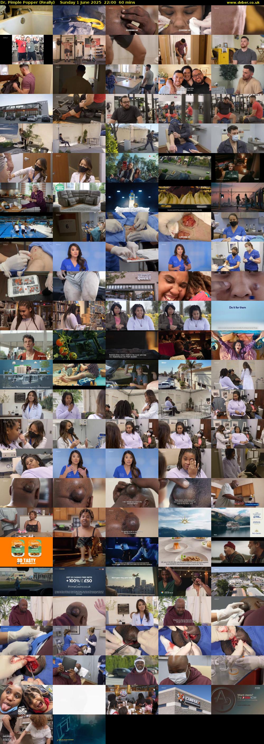 Dr. Pimple Popper (Really) Sunday 1 June 2025 22:00 - 23:00