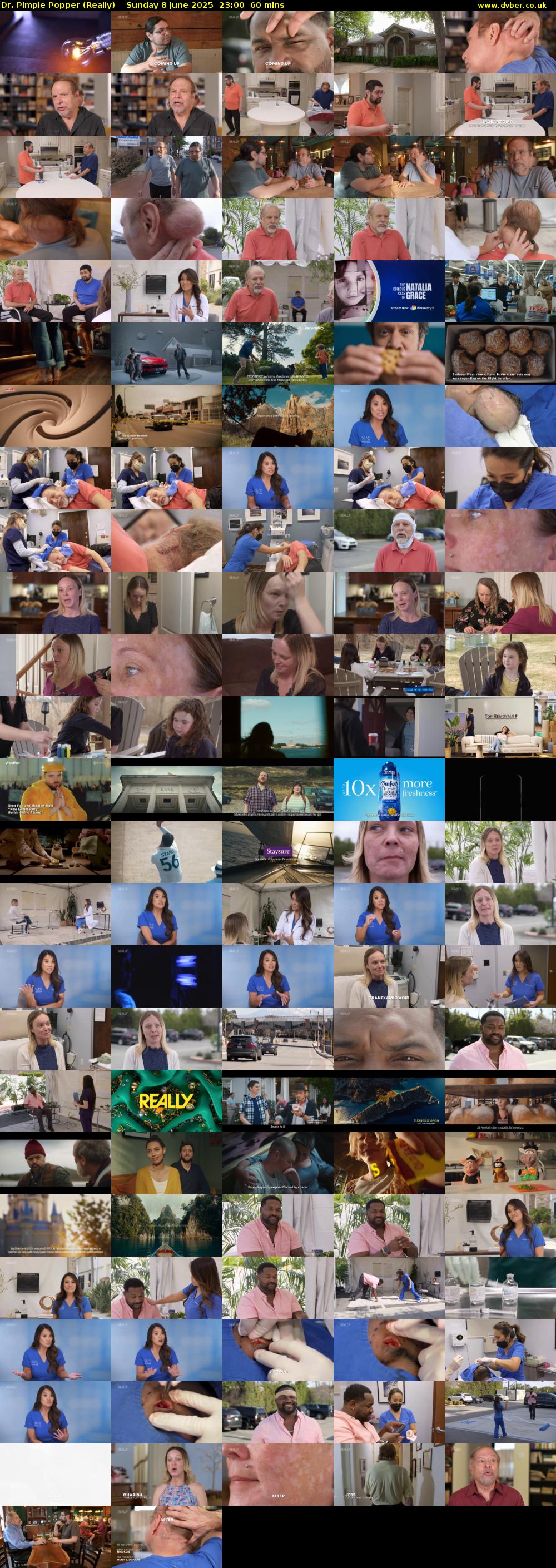 Dr. Pimple Popper (Really) Sunday 8 June 2025 23:00 - 00:00