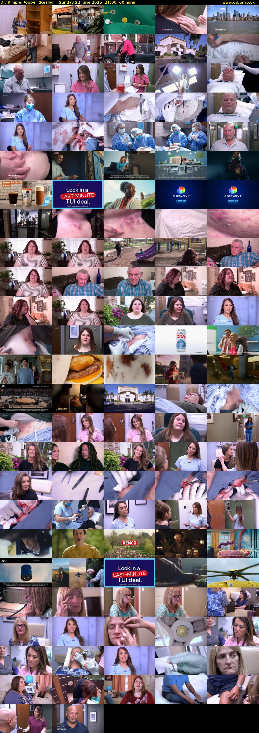 Dr. Pimple Popper (Really) Sunday 22 June 2025 21:00 - 22:00