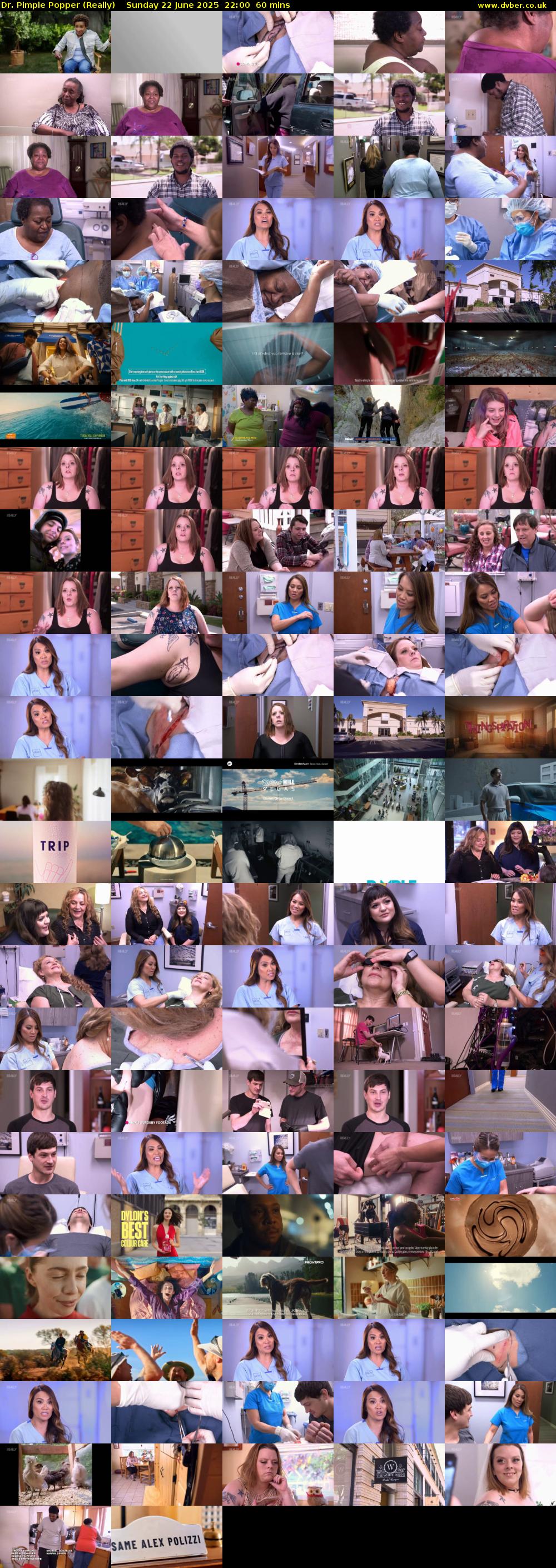 Dr. Pimple Popper (Really) Sunday 22 June 2025 22:00 - 23:00