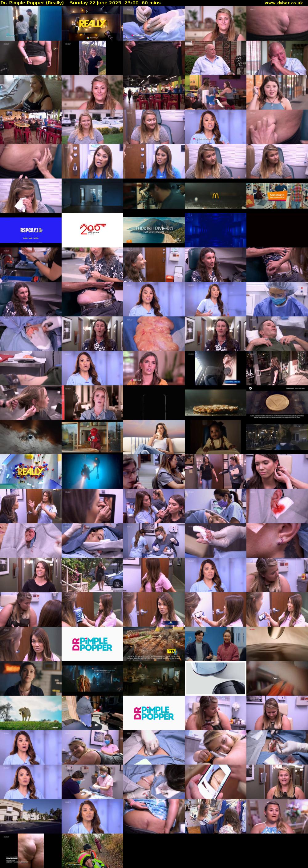 Dr. Pimple Popper (Really) Sunday 22 June 2025 23:00 - 00:00