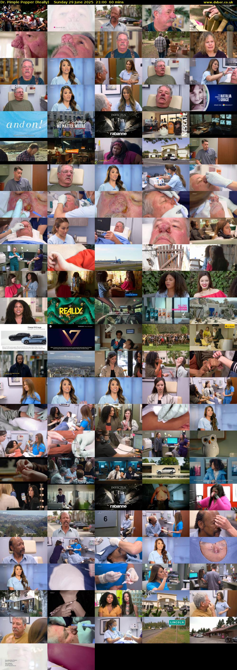 Dr. Pimple Popper (Really) Sunday 29 June 2025 21:00 - 22:00