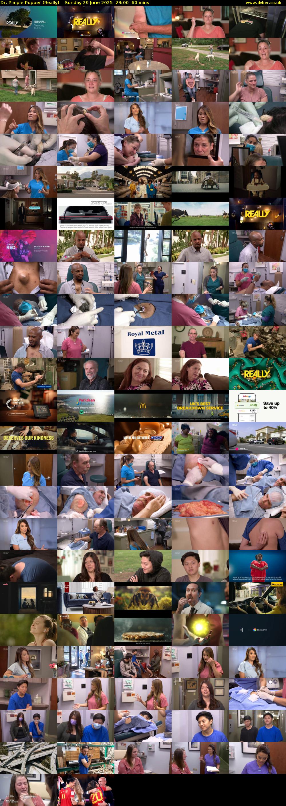 Dr. Pimple Popper (Really) Sunday 29 June 2025 23:00 - 00:00