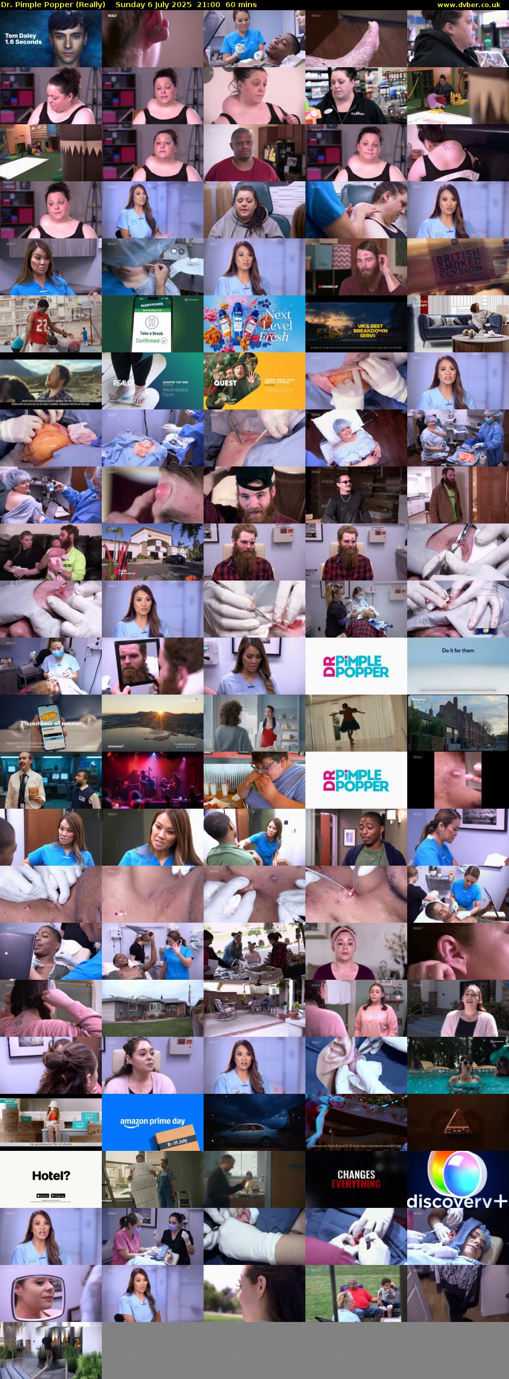 Dr. Pimple Popper (Really) Sunday 6 July 2025 21:00 - 22:00