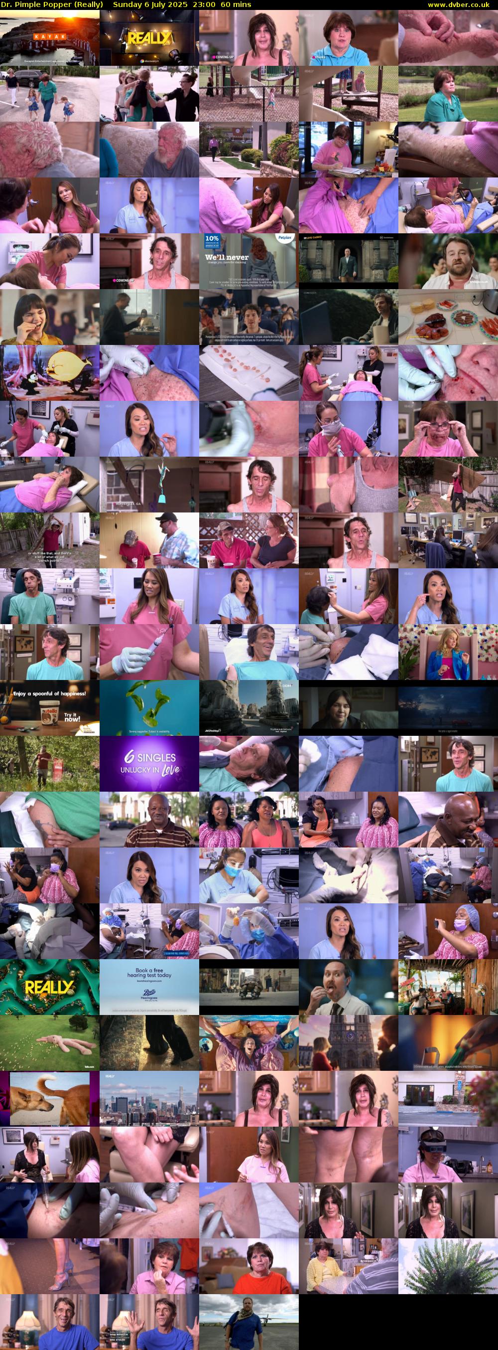 Dr. Pimple Popper (Really) Sunday 6 July 2025 23:00 - 00:00