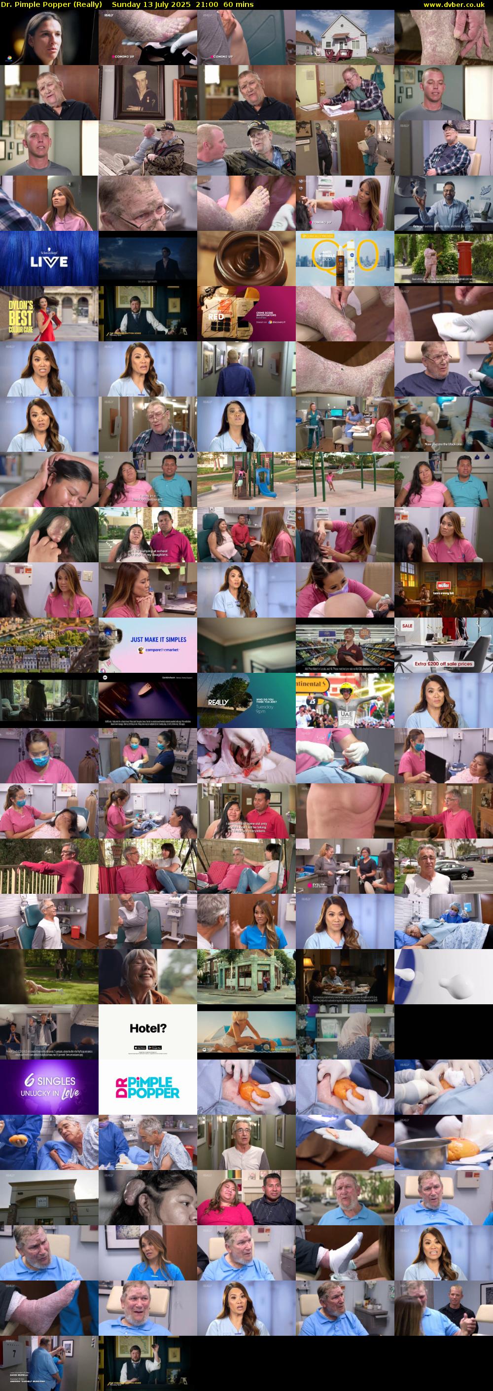 Dr. Pimple Popper (Really) Sunday 13 July 2025 21:00 - 22:00