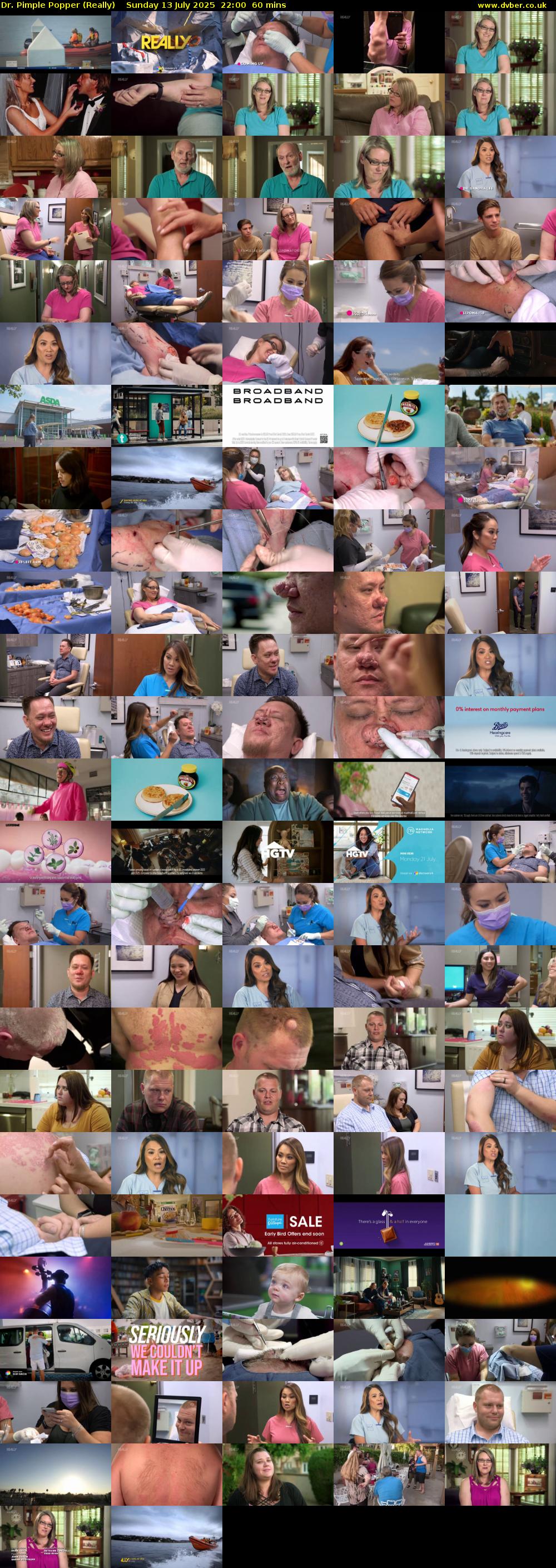 Dr. Pimple Popper (Really) Sunday 13 July 2025 22:00 - 23:00