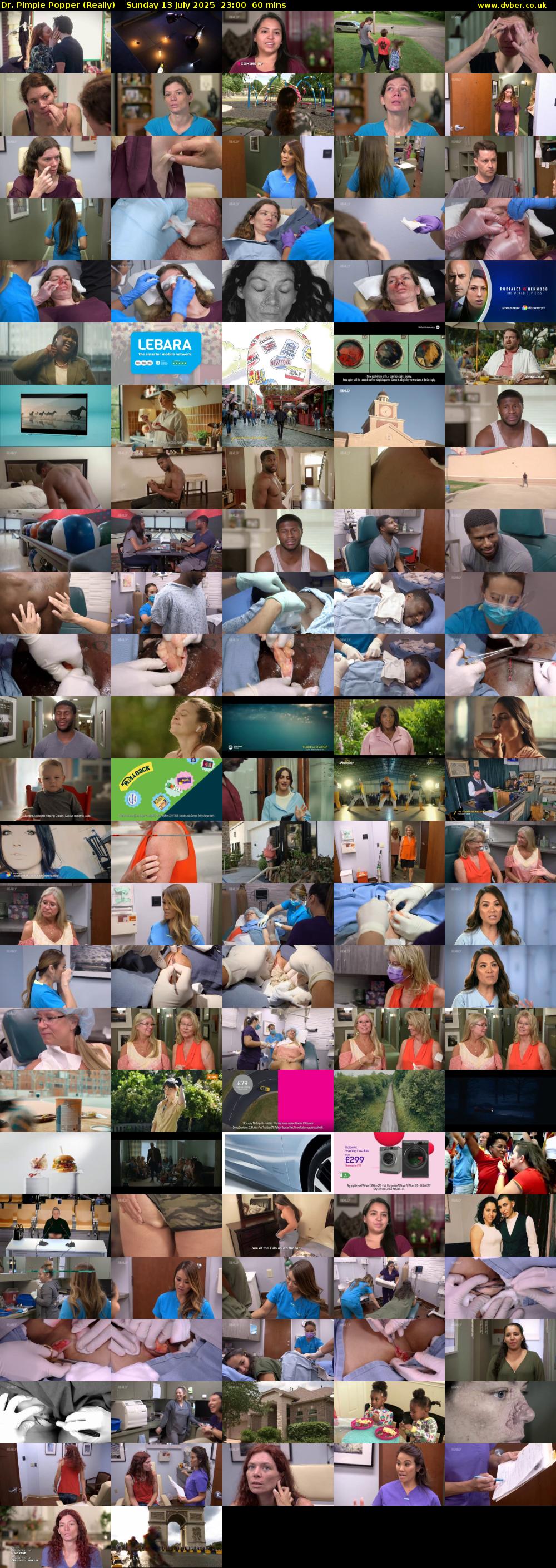 Dr. Pimple Popper (Really) Sunday 13 July 2025 23:00 - 00:00