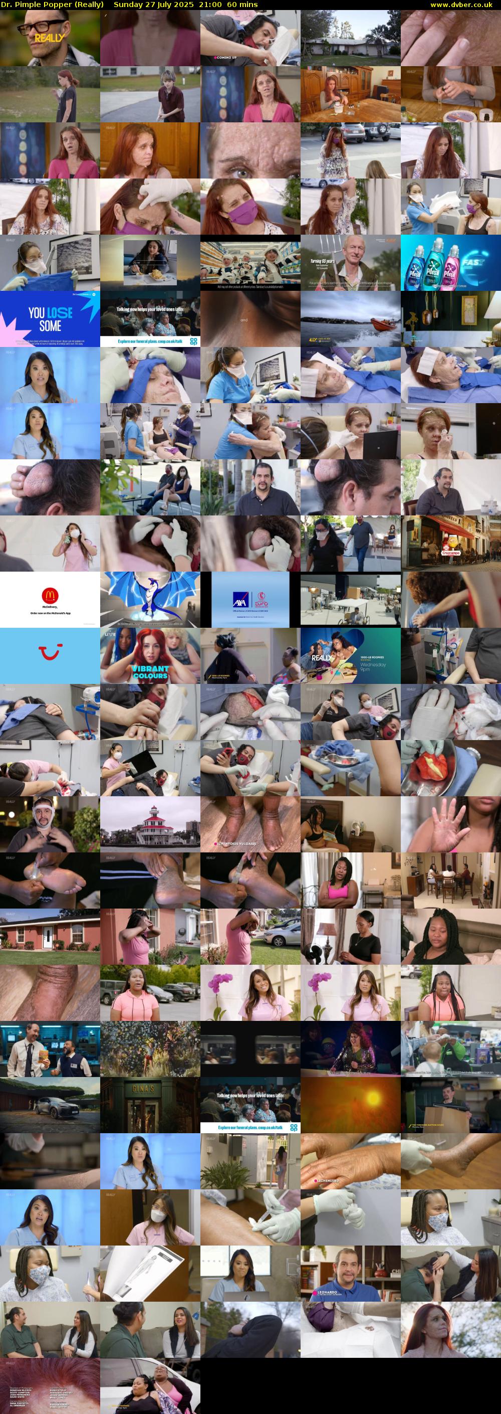 Dr. Pimple Popper (Really) Sunday 27 July 2025 21:00 - 22:00