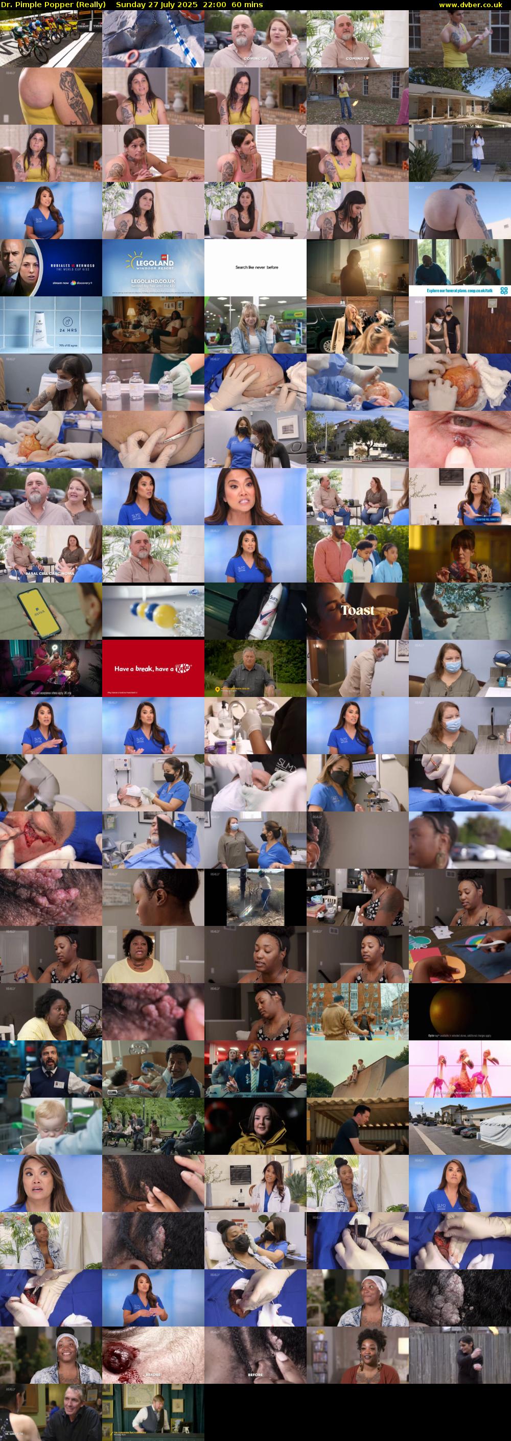Dr. Pimple Popper (Really) Sunday 27 July 2025 22:00 - 23:00