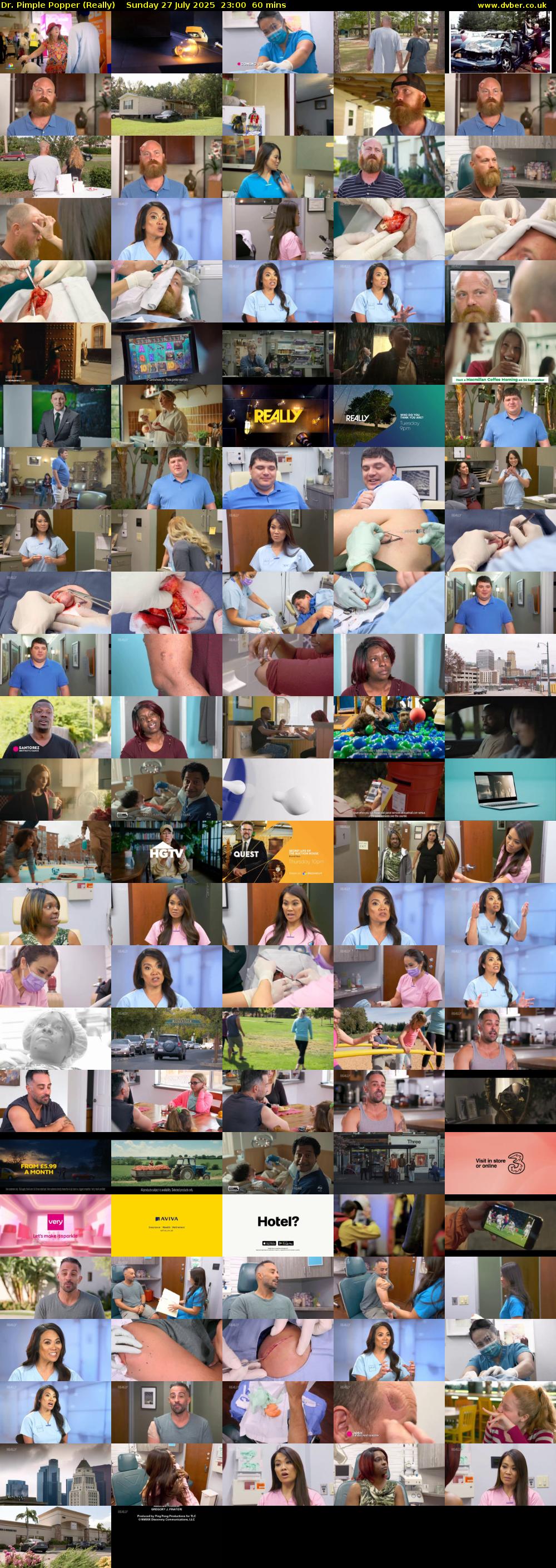 Dr. Pimple Popper (Really) Sunday 27 July 2025 23:00 - 00:00