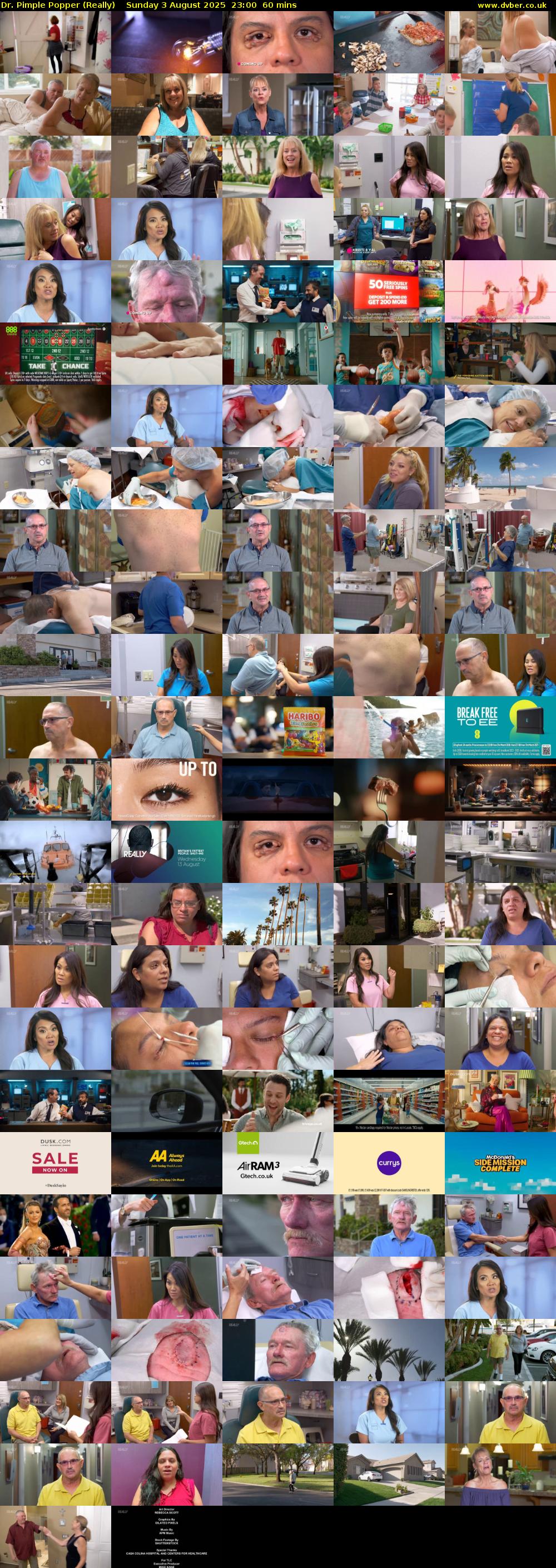 Dr. Pimple Popper (Really) Sunday 3 August 2025 23:00 - 00:00