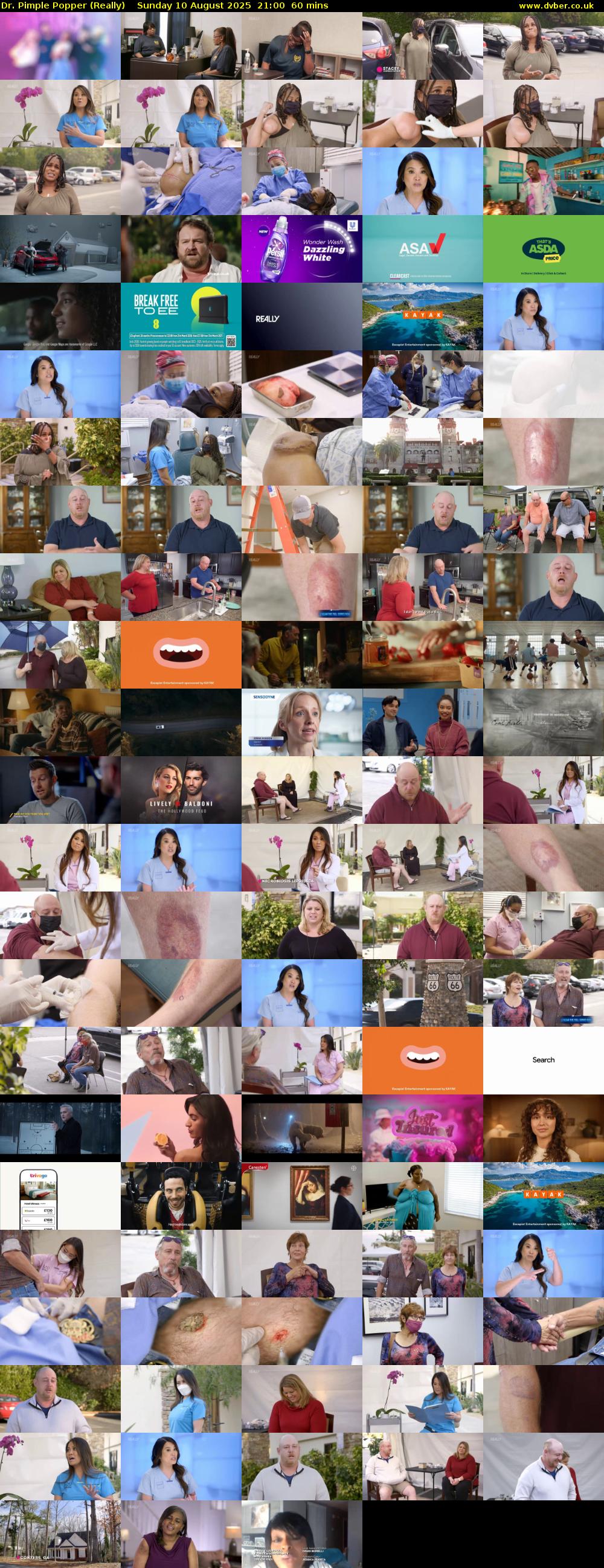 Dr. Pimple Popper (Really) Sunday 10 August 2025 21:00 - 22:00