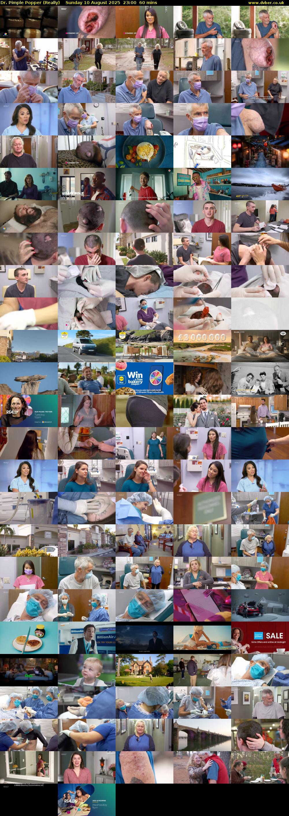 Dr. Pimple Popper (Really) Sunday 10 August 2025 23:00 - 00:00