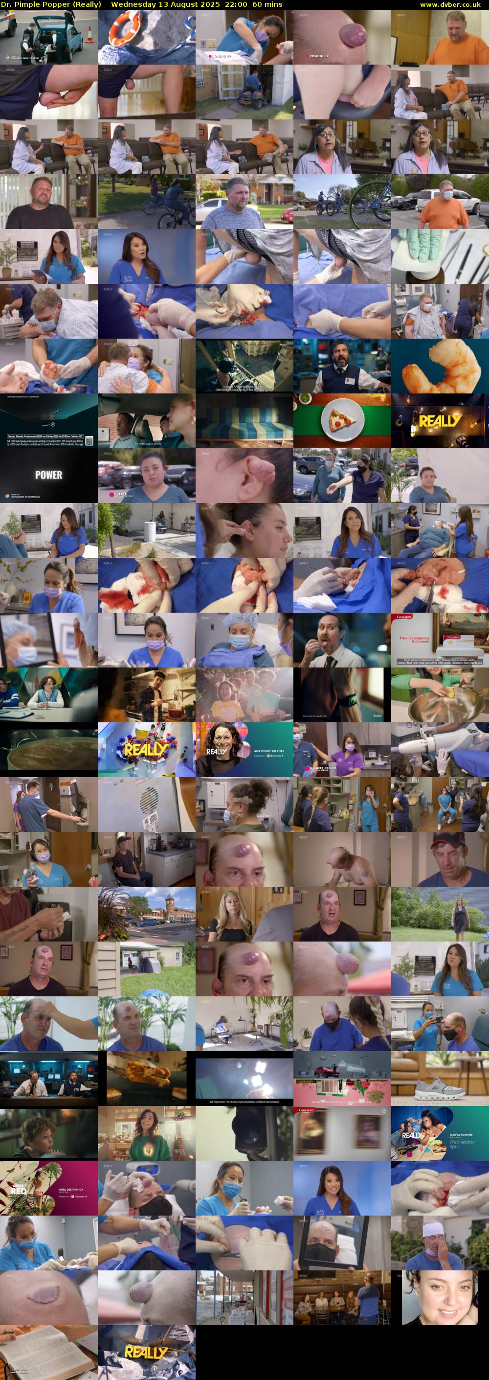 Dr. Pimple Popper (Really) Wednesday 13 August 2025 22:00 - 23:00