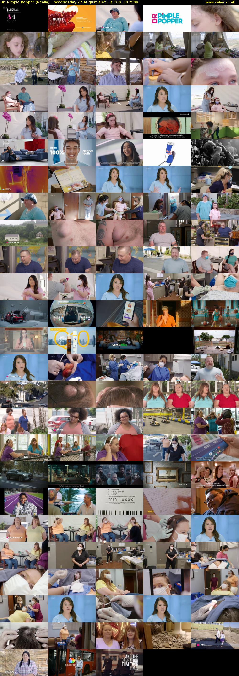 Dr. Pimple Popper (Really) Wednesday 27 August 2025 23:00 - 00:00