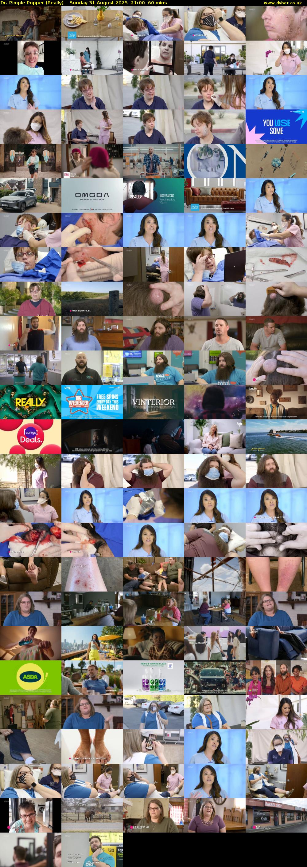 Dr. Pimple Popper (Really) Sunday 31 August 2025 21:00 - 22:00