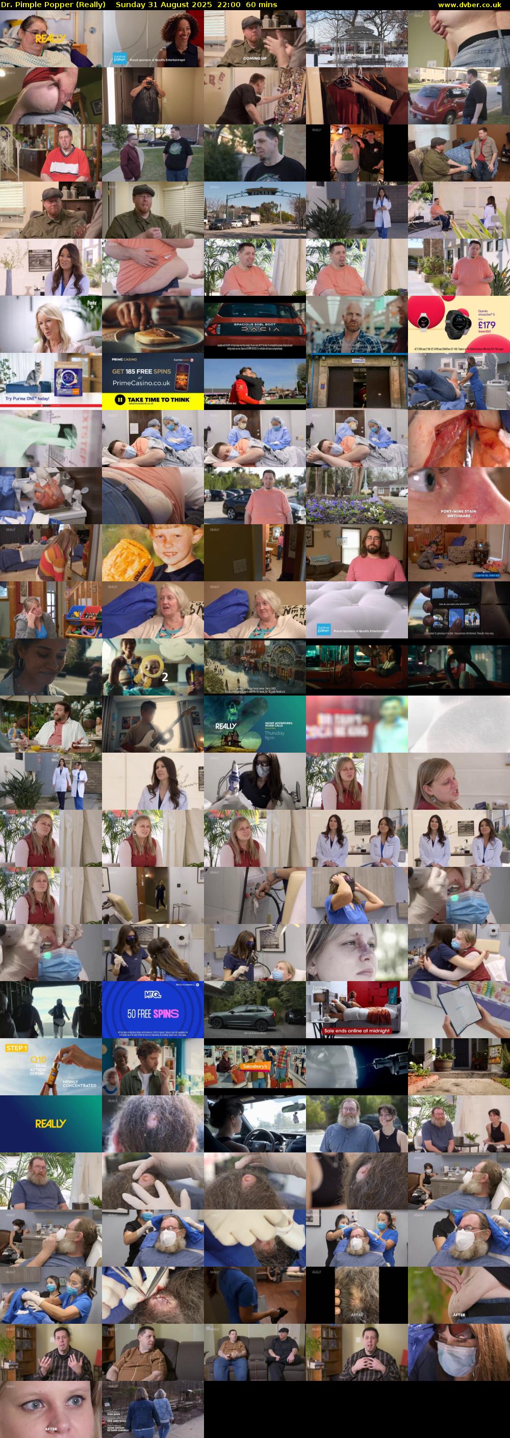 Dr. Pimple Popper (Really) Sunday 31 August 2025 22:00 - 23:00