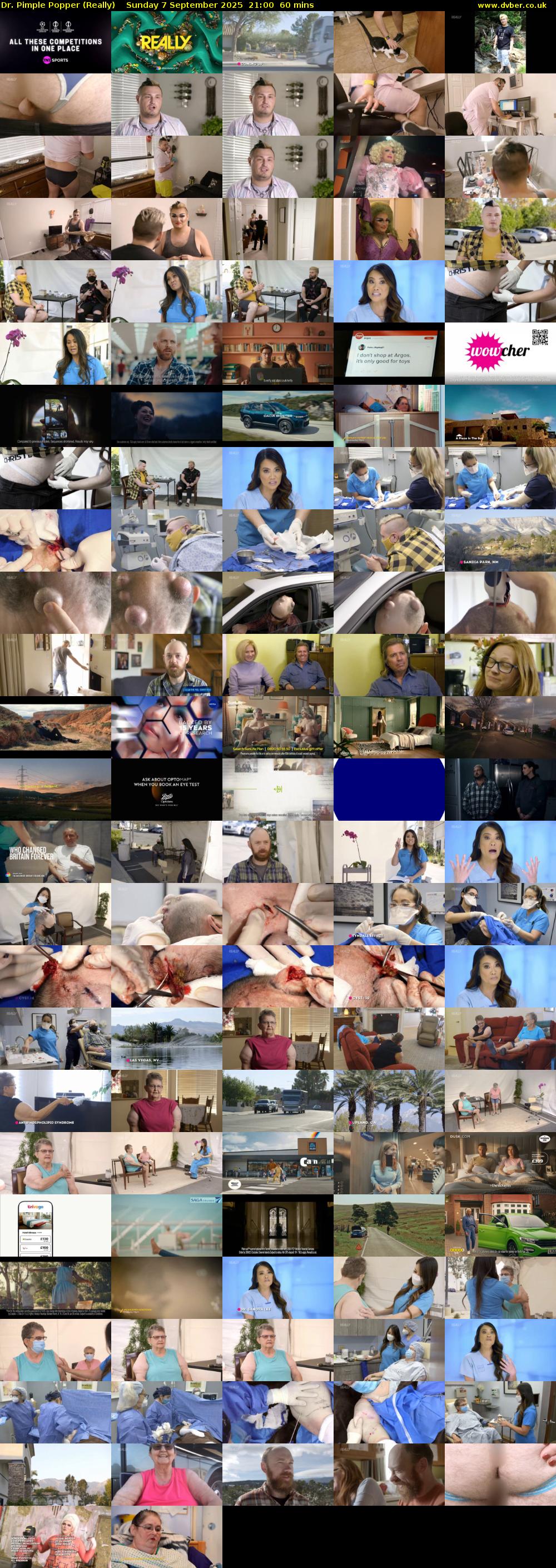 Dr. Pimple Popper (Really) Sunday 7 September 2025 21:00 - 22:00