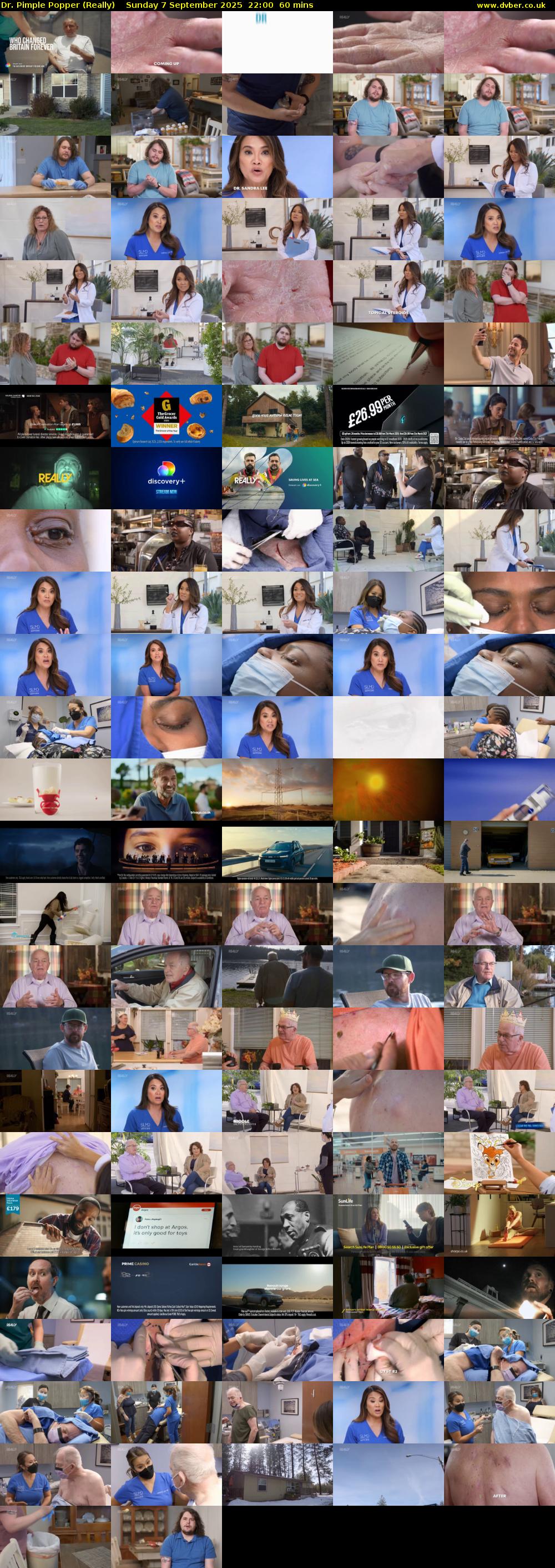 Dr. Pimple Popper (Really) Sunday 7 September 2025 22:00 - 23:00