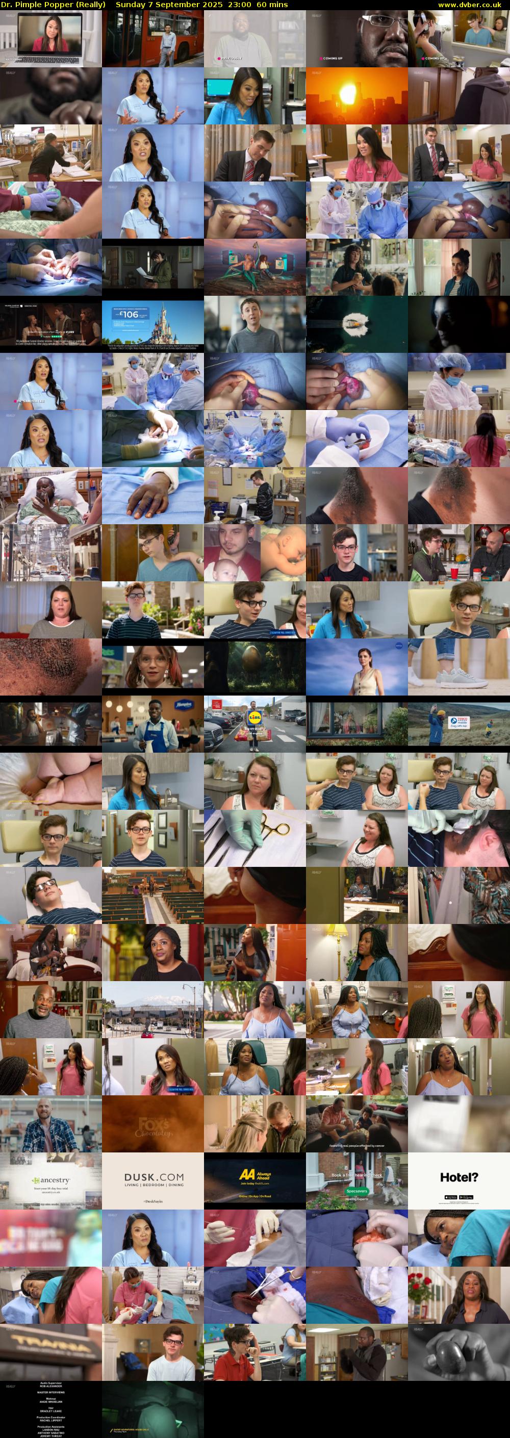 Dr. Pimple Popper (Really) Sunday 7 September 2025 23:00 - 00:00