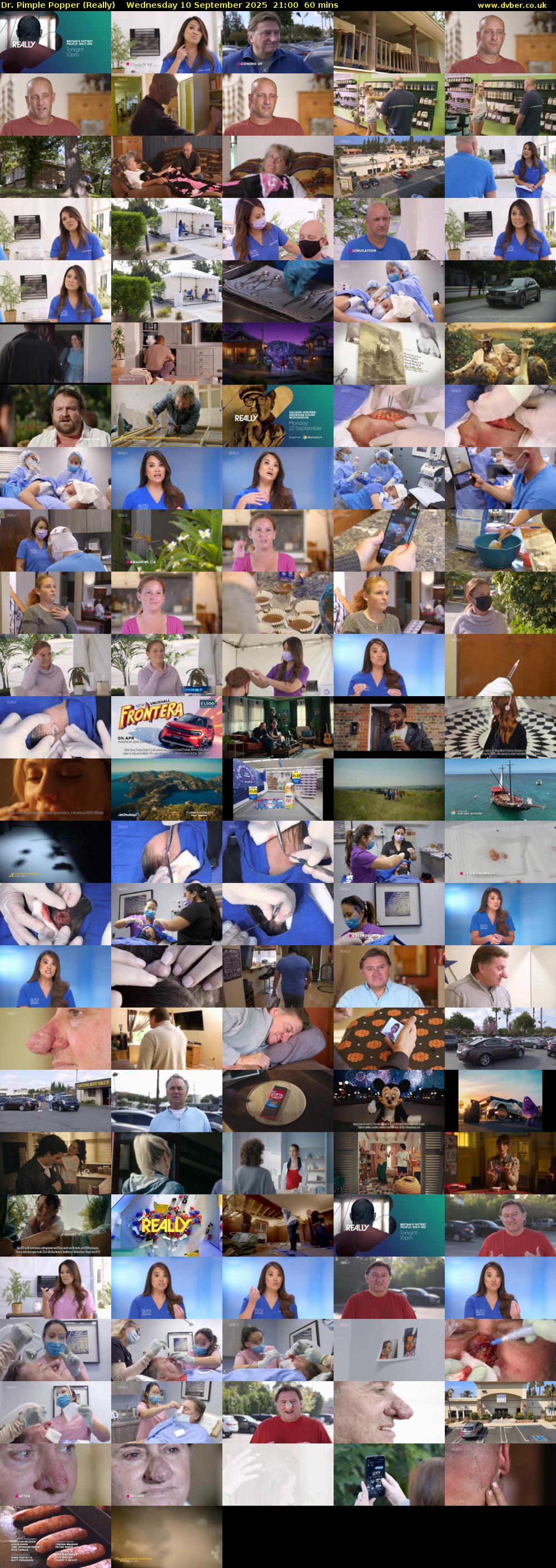 Dr. Pimple Popper (Really) Wednesday 10 September 2025 21:00 - 22:00