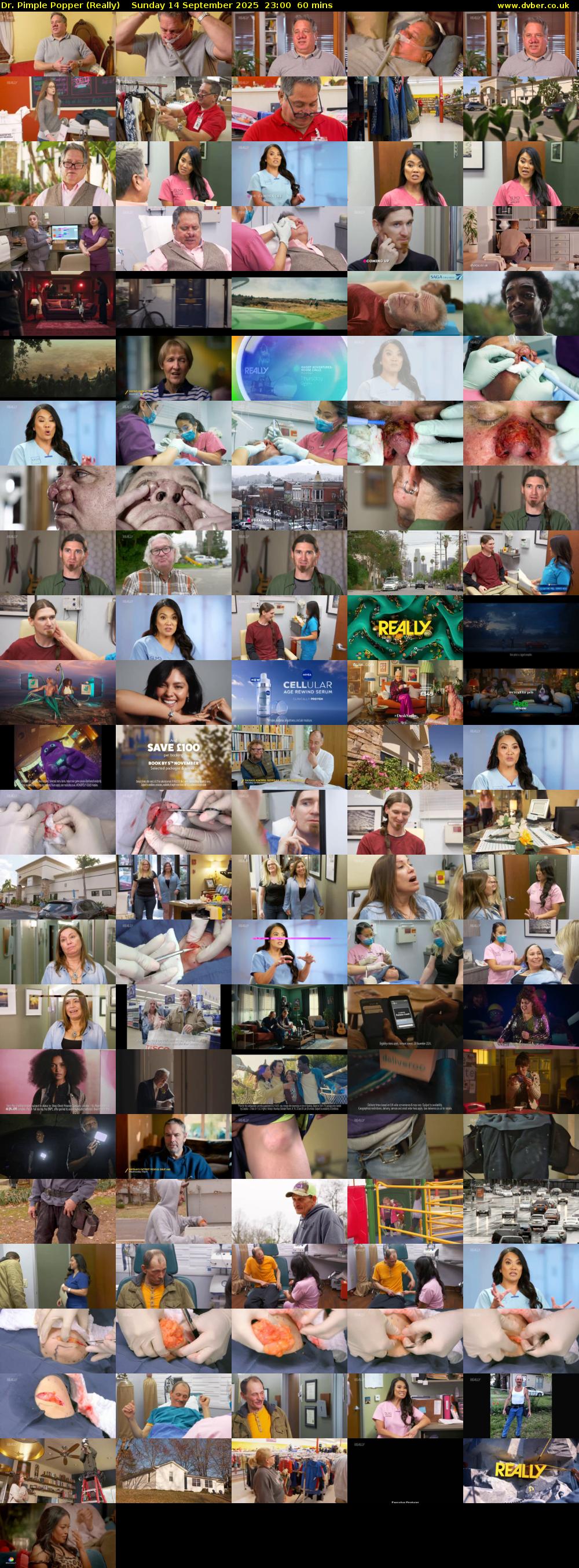 Dr. Pimple Popper (Really) Sunday 14 September 2025 23:00 - 00:00