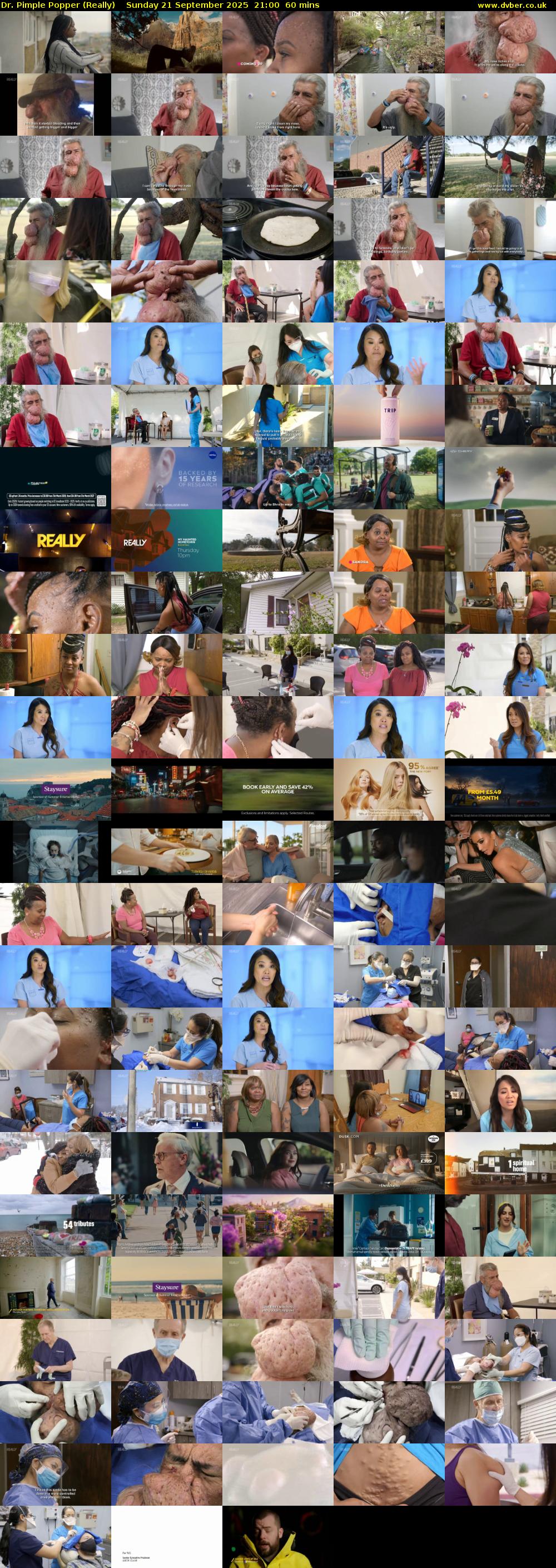 Dr. Pimple Popper (Really) Sunday 21 September 2025 21:00 - 22:00