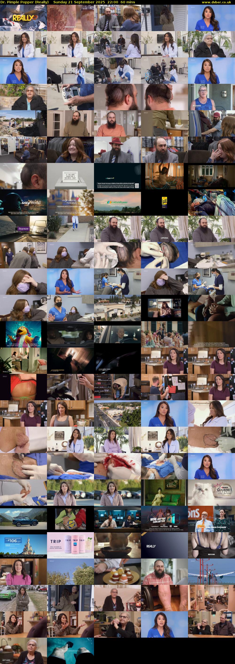 Dr. Pimple Popper (Really) Sunday 21 September 2025 22:00 - 23:00
