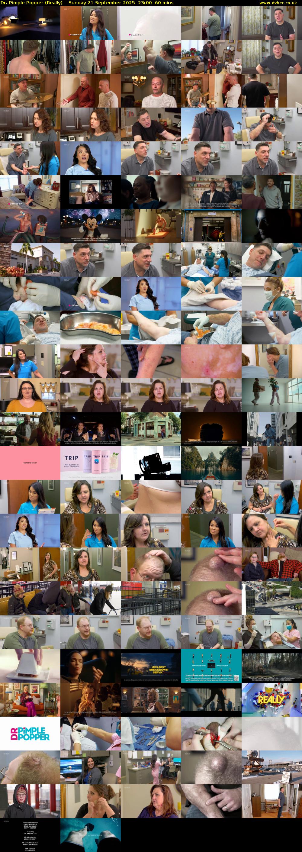 Dr. Pimple Popper (Really) Sunday 21 September 2025 23:00 - 00:00