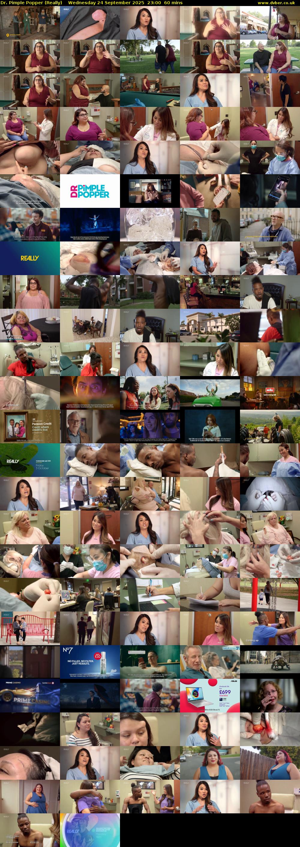 Dr. Pimple Popper (Really) Wednesday 24 September 2025 23:00 - 00:00