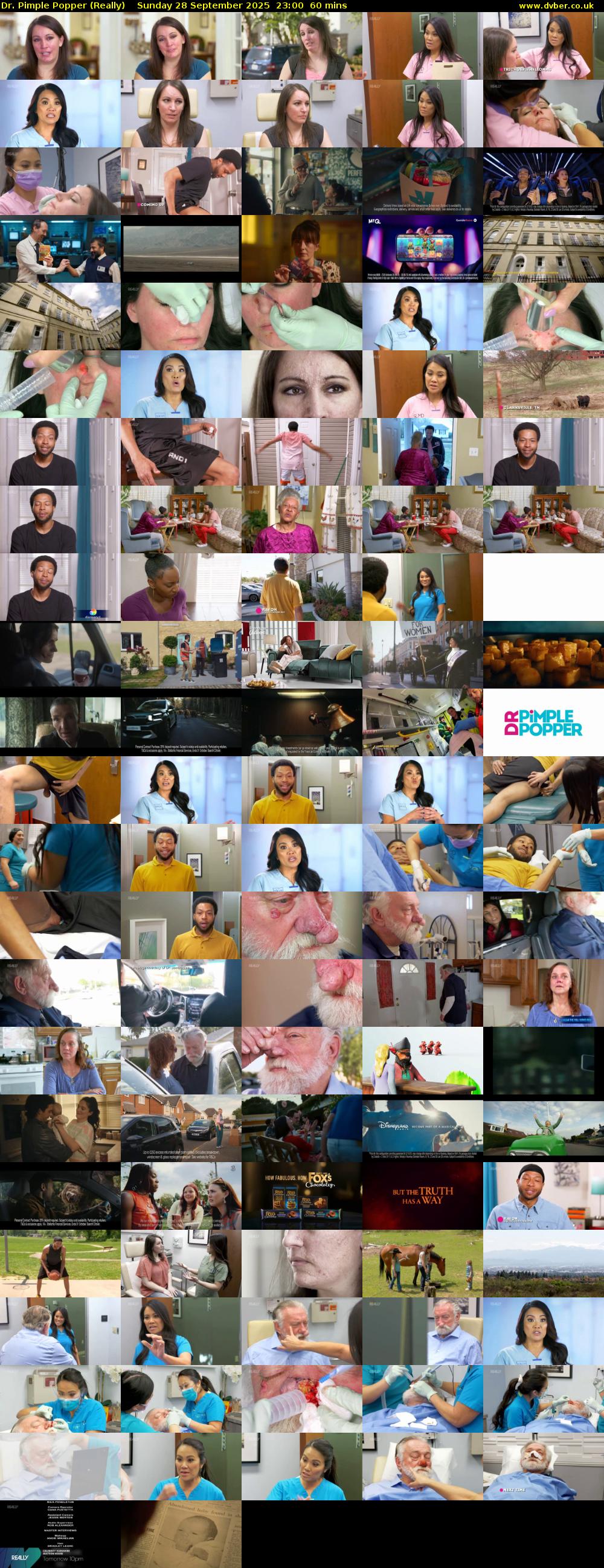 Dr. Pimple Popper (Really) Sunday 28 September 2025 23:00 - 00:00