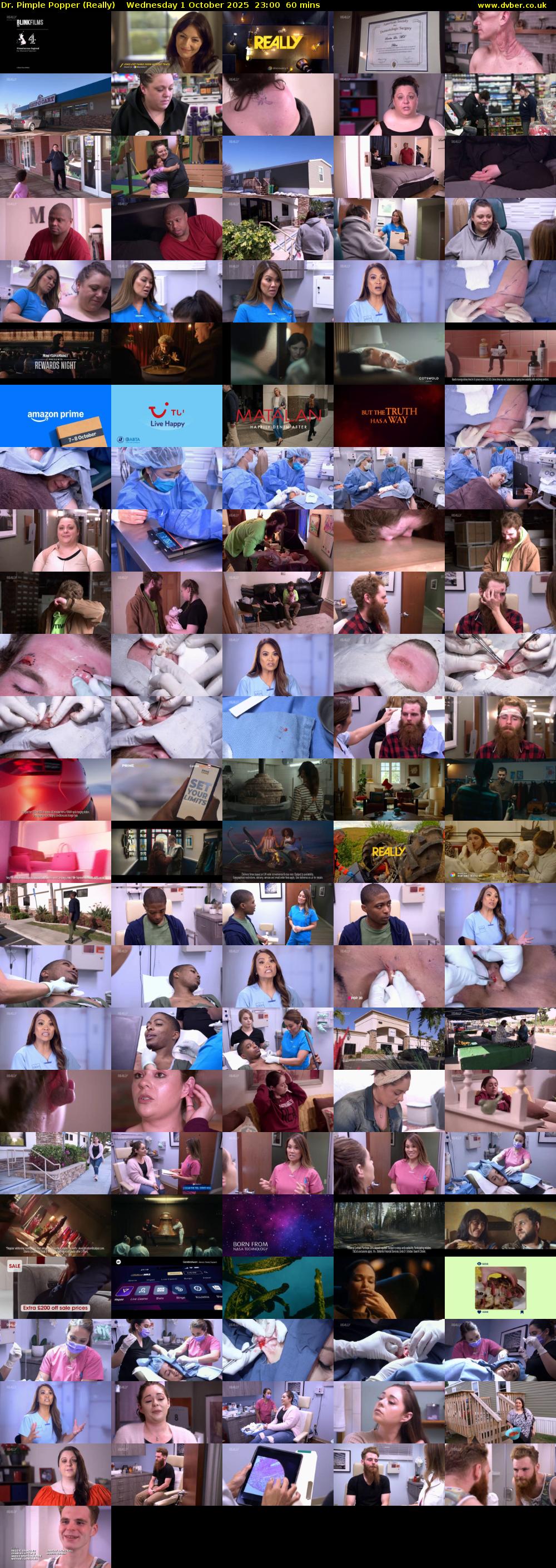 Dr. Pimple Popper (Really) Wednesday 1 October 2025 23:00 - 00:00