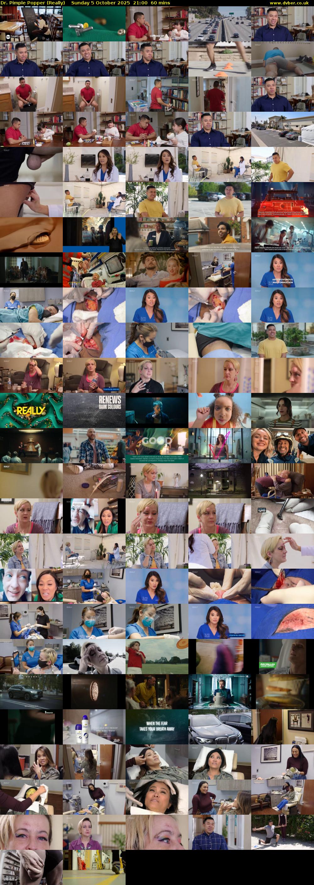Dr. Pimple Popper (Really) Sunday 5 October 2025 21:00 - 22:00