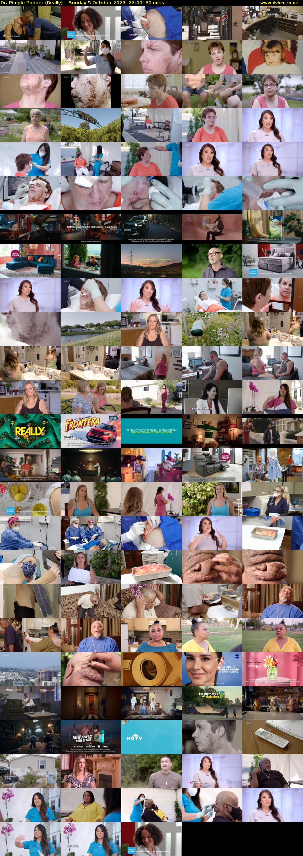 Dr. Pimple Popper (Really) Sunday 5 October 2025 22:00 - 23:00