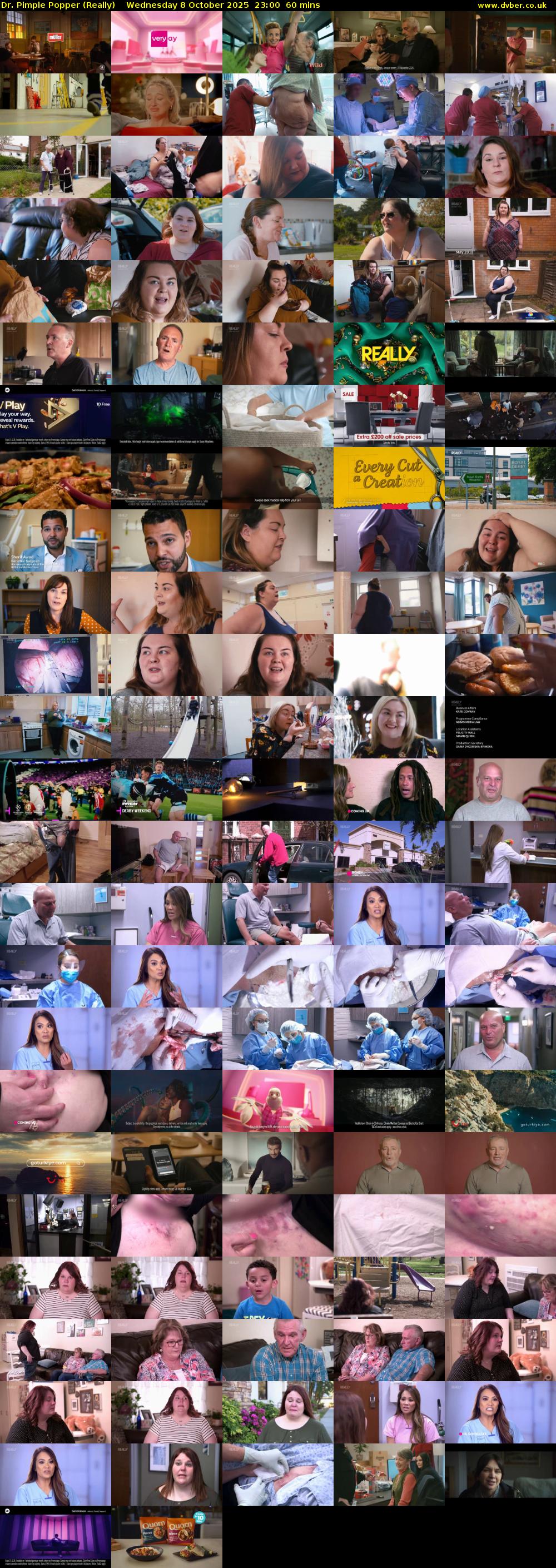 Dr. Pimple Popper (Really) Wednesday 8 October 2025 23:00 - 00:00