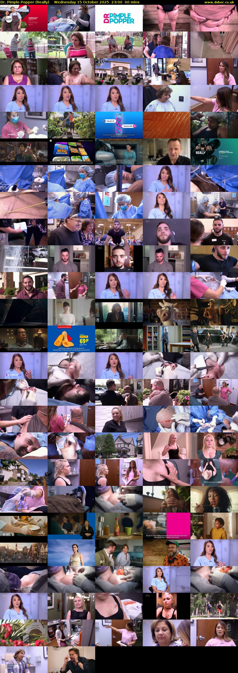 Dr. Pimple Popper (Really) Wednesday 15 October 2025 23:00 - 00:00