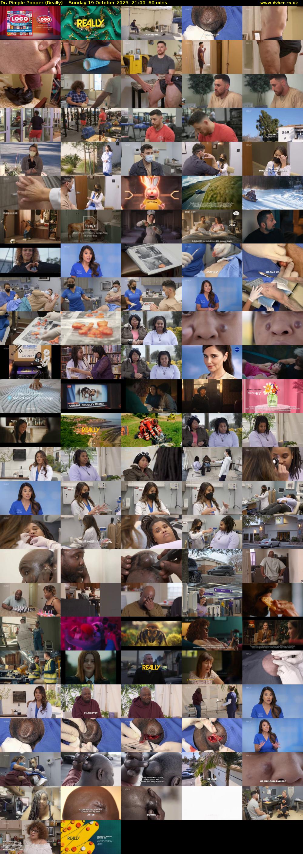 Dr. Pimple Popper (Really) Sunday 19 October 2025 21:00 - 22:00