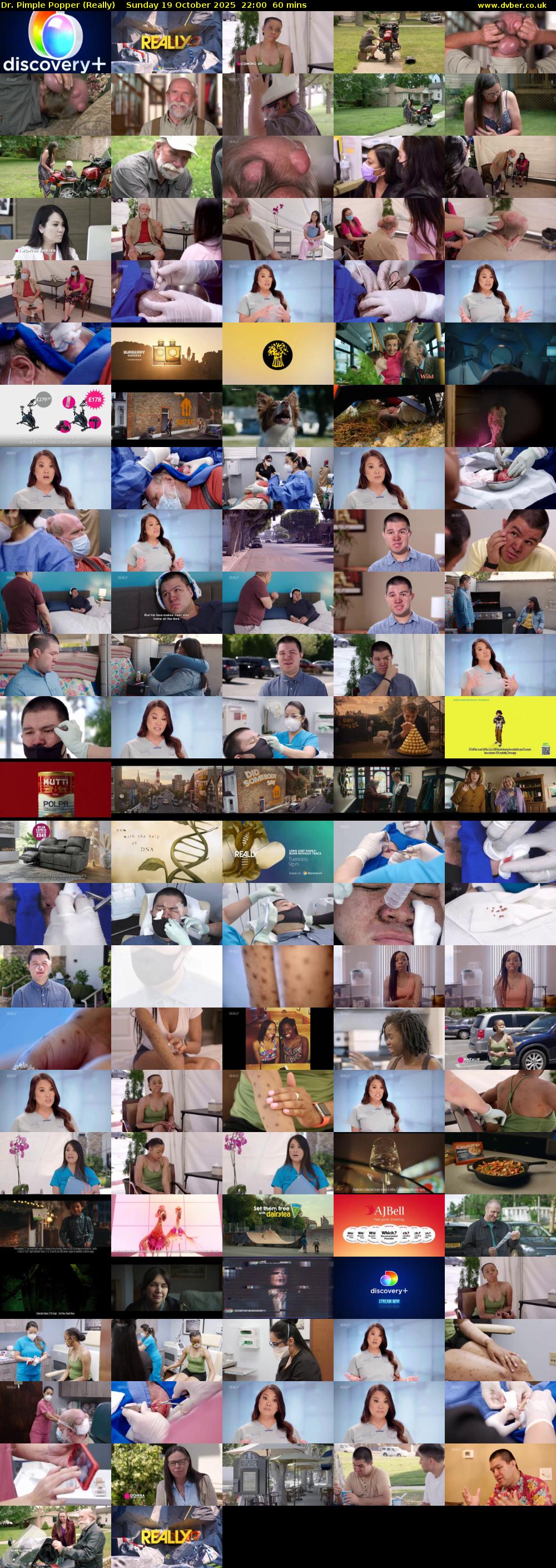 Dr. Pimple Popper (Really) Sunday 19 October 2025 22:00 - 23:00